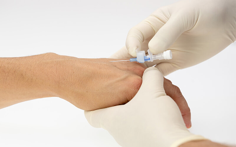 I.V Cannula Insertion